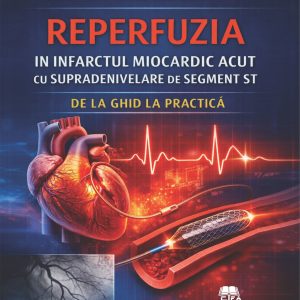Reperfuzia în infarctul miocardic acut cu supradenivelare de segment ST de la ghid la practică
